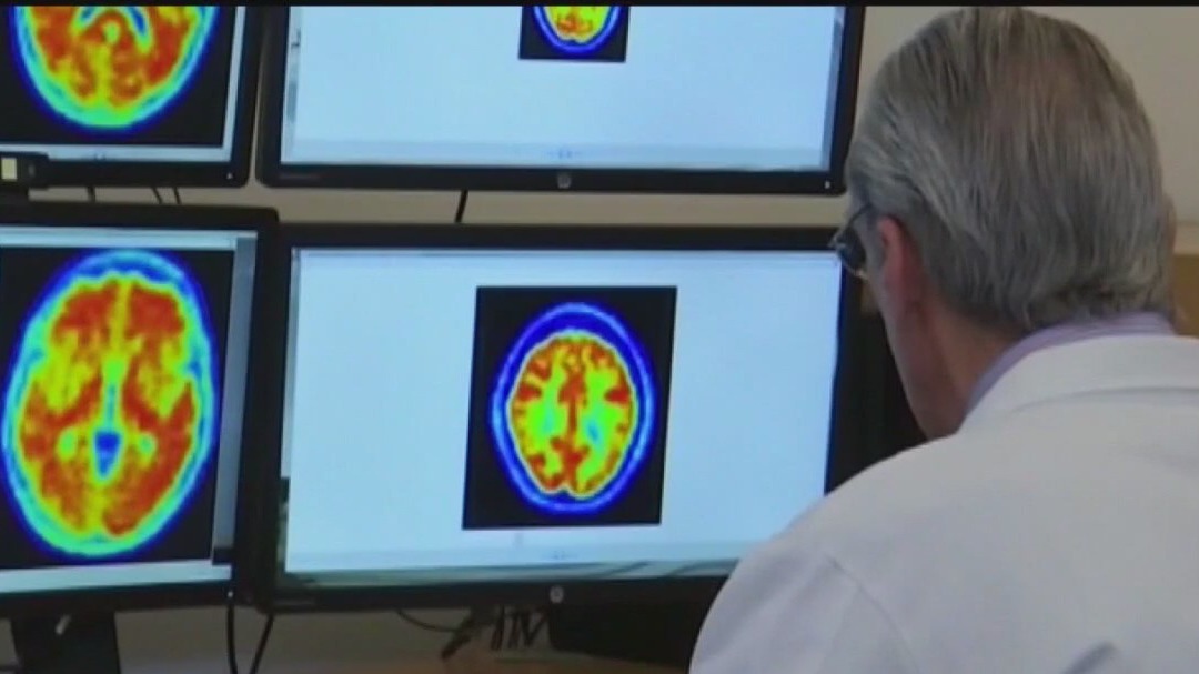 Relief for chronic pain may start with the brain